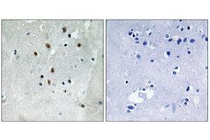 Immunohistochemistry (IHC) image for anti-Serum Response Factor (SRF) (pSer77) antibody (ABIN1847571) (SRF antibody  (pSer77))