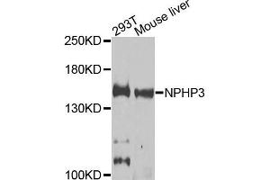 Western blot analysis of extracts of 293T and mouse liver cells, using NPHP3 antibody.