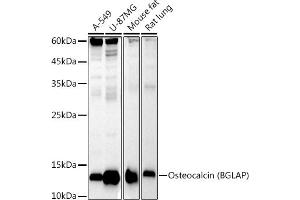 Western blot analysis of extracts of various cell lines, using Osteocalcin (BGLAP) antibody (ABIN7269118) at 1:1000 dilution. (Osteocalcin antibody)
