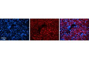 Rabbit Anti-DPH1 Antibody Catalog Number: ARP51955_P050 Formalin Fixed Paraffin Embedded Tissue: Human Liver Tissue Observed Staining: Cytoplasm in hepatocytes Primary Antibody Concentration: 1:100 Other Working Concentrations: 1:600 Secondary Antibody: Donkey anti-Rabbit-Cy3 Secondary Antibody Concentration: 1:200 Magnification: 20X Exposure Time: 0. (DPH1 antibody  (N-Term))