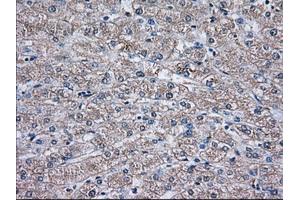 Immunohistochemical staining of paraffin-embedded Human liver tissue using anti-TBXAS1 mouse monoclonal antibody. (TBXAS1 antibody)