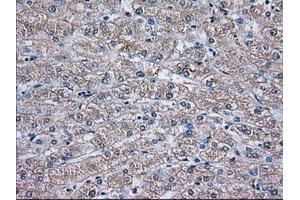 Immunohistochemical staining of paraffin-embedded Human liver tissue using anti-TBXAS1 mouse monoclonal antibody.