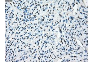 Immunohistochemical staining of paraffin-embedded Ovary tissue using anti-TMEM100mouse monoclonal antibody. (TMEM100 antibody)
