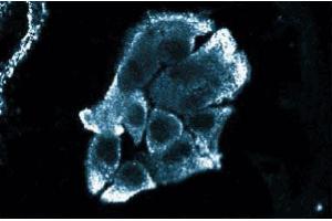 Immunofluorescence staining of HS 766T cells (Human pancreatic carcinoma, ATCC HTB-134).