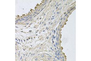 Immunohistochemistry of paraffin-embedded human prostate using HERC3 antibody at dilution of 1:100 (x40 lens). (HERC3 antibody)