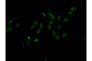Immunofluorescence staining of Hela Cells with ABIN7127650 at 1:50, counter-stained with DAPI.