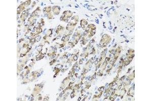 Immunohistochemistry of paraffin-embedded Mouse stomach using TIMM10B Polyclonal Antibody at dilution of 1:100 (40x lens). (TIMM10B antibody)