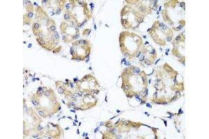 Immunohistochemistry of paraffin-embedded Human stomach using RBP2 Polyclonal Antibody at dilution of 1:100 (40x lens).