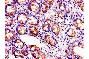 Immunohistochemistry of paraffin-embedded human small intestine tissue using ABIN7149308 at dilution of 1:100 (Aconitase 1 antibody  (AA 508-745))