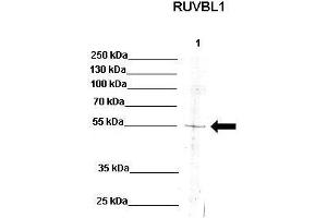 Western Blotting (WB) image for anti-RuvB-Like 1 (E. Coli) (RUVBL1) (N-Term) antibody (ABIN2779583)