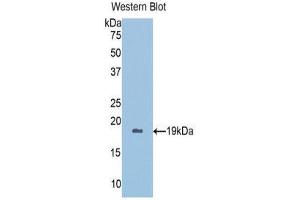 Western Blotting (WB) image for anti-Peroxiredoxin 5 (PRDX5) (AA 1-162) antibody (ABIN1078432) (Peroxiredoxin 5 antibody  (AA 1-162))