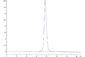 The purity of SARS-CoV-2 Spike S1 (Lambda C. (SARS-CoV-2 Spike S1 Protein (C.37 - Lambda) (His tag))
