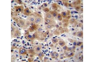 NEU2 antibody immunohistochemistry analysis in formalin fixed and paraffin embedded human liver tissue. (NEU2 antibody  (AA 23-50))