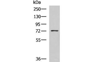 Western blot analysis of K562 cell lysate using GUSB Polyclonal Antibody at dilution of 1:800 (Glucuronidase beta antibody)