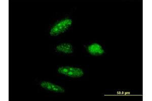 Immunofluorescence of purified MaxPab antibody to RTCD1 on HeLa cell. (RTCD1 antibody  (AA 1-366))
