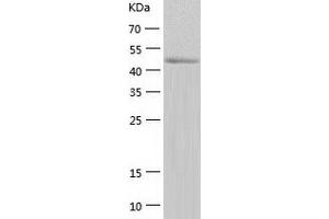 YARS2 Protein (AA 17-477) (His tag)