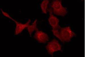 ABIN6277390 staining HepG2 by IF/ICC. (KISS1 antibody  (Internal Region))