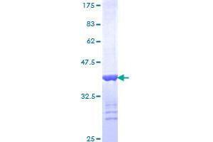 ERBB2IP Protein (AA 1272-1371) (GST tag)