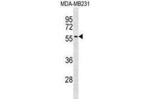 Western Blotting (WB) image for anti-A Kinase (PRKA) Anchor Protein 5 (AKAP5) antibody (ABIN3000745) (AKAP5 antibody)