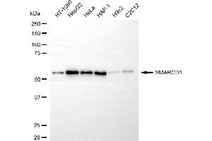 Western blotting analysis using SMARCD1 antibody (ABIN7800480).