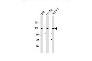 All lanes : Anti-LRIG3 Antibody (N-Term) at 1:2000 dilution Lane 1: Hela whole cell lysate Lane 2: HepG2 whole cell lysate Lane 3: 293T/17 whole cell lysate Lysates/proteins at 20 μg per lane. (LRIG3 antibody  (AA 23-54))