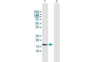 Western Blot analysis of BST2 expression in transfected 293T cell line by BST2 MaxPab polyclonal antibody. (BST2 antibody  (AA 40-180))