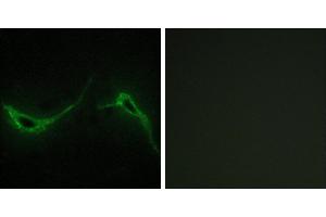 Peptide - +Immunohistochemistry analysis of paraffin-embedded human brain tissue using ADCY7 antibody. (ADCY7 antibody)