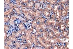 Detection of MCP1 in Rat Kidney Tissue using Polyclonal Antibody to Monocyte Chemotactic Protein 1 (MCP1) (CCL2 antibody  (AA 24-148))