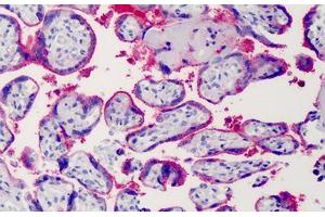 Human Placenta: Formalin-Fixed, Paraffin-Embedded (FFPE) (Syndecan 1 antibody)