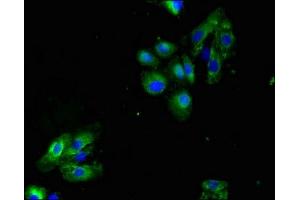 Immunofluorescent analysis of HepG2 cells using ABIN7158651 at dilution of 1:100 and Alexa Fluor 488-congugated AffiniPure Goat Anti-Rabbit IgG(H+L) (LAX1 antibody  (AA 107-298))