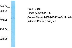 Host: Rabbit Target Name: GPR142 Sample Type: MDA-MB-435s Whole Cell lysates Antibody Dilution: 1. (GPR142 antibody  (N-Term))