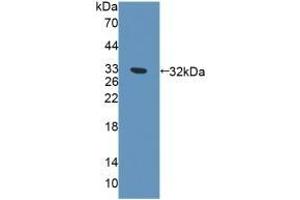 Detection of Recombinant EXO1, Human using Polyclonal Antibody to Exonuclease 1 (EXO1) (Exonuclease 1 antibody  (AA 1-250))