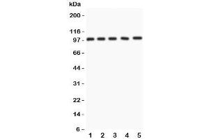 Western blot testing of NUP98 antibody and Lane 1:  rat liver;  2: mouse liver;  3: (m) lung;  4: human A549;  5: (h) SMMC-7721 lysate.