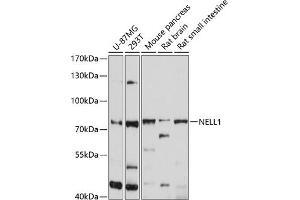 Western blot analysis of extracts of various cell lines, using NELL1 antibody (ABIN6132410, ABIN6144530, ABIN6144531 and ABIN6214585) at 1:1000 dilution.