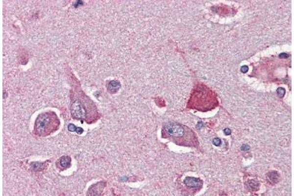 SIM1 antibody