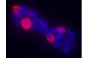 Immunofluorescence (IF) image for anti-Zinc Finger Protein GLI1 (GLI1) (AA 805-820) antibody (ABIN6657594)