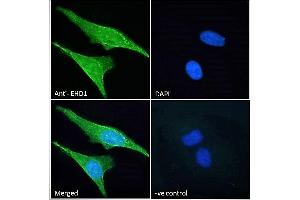 ABIN7013871 Immunofluorescence analysis of paraformaldehyde fixed HeLa cells, permeabilized with 0. (EHD1 antibody  (N-Term))