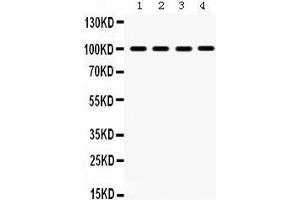 Western Blotting (WB) image for anti-Mitogen-Activated Protein Kinase 6 (MAPK6) (AA 520-721) antibody (ABIN3043611) (MAPK6 antibody  (AA 520-721))