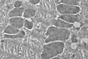 Immunoelectron microscopy analysis of LR white resin-embedded mouse heart using HSP60 (ABIN7074167) at dilution of 1: 50. (HSPD1 antibody)