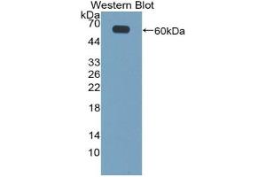 Detection of Recombinant CILP, Mouse using Polyclonal Antibody to Cartilage Intermediate Layer Protein (CILP) (CILP antibody  (AA 604-864))