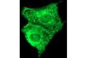 Image no. 3 for anti-Fetal and Adult Testis Expressed 1 (FATE1) antibody (ABIN1498224) (FATE1 antibody)