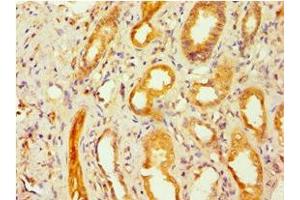 Immunohistochemistry of paraffin-embedded human kidney tissue using ABIN7153663 at dilution of 1:100 (Non-Syndromic Hearing Impairment Protein 5 (GSDME) (AA 1-260) antibody)