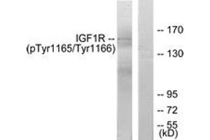 Western blot analysis of extracts from 293 cells treated with Insulin, using IGF1R (Phospho-Tyr1165/Tyr1166) Antibody. (IGF1R antibody  (pTyr1165))