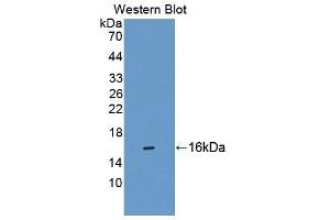 Detection of Recombinant CBY1, Human using Polyclonal Antibody to Chibby Homolog 1 (CBY1) (CBY1/PGEA1 antibody  (AA 12-115))