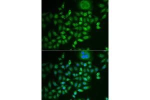 Immunofluorescence analysis of MCF-7 cells using SCG2 antibody (ABIN5973825). (SCG2 antibody)