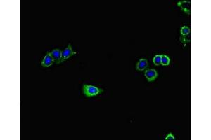 Immunofluorescent analysis of HepG2 cells using ABIN7154769 at dilution of 1:100 and Alexa Fluor 488-congugated AffiniPure Goat Anti-Rabbit IgG(H+L) (GUCY1A1 antibody  (AA 20-152))