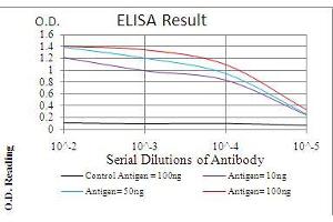 Black line: Control Antigen (100 ng), Purple line: Antigen(10 ng), Blue line: Antigen (50 ng), Red line: Antigen (100 ng), (TERT antibody  (AA 1029-1132))