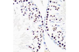 Immunohistochemistry of paraffin-embedded Rat testis using MYEF2 Rabbit pAb (ABIN7268721) at dilution of 1:100 (40x lens).