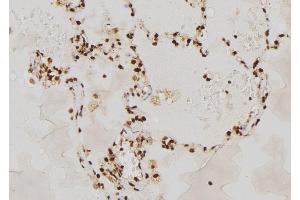ABIN6277666 at 1/100 staining Human lung tissue by IHC-P.