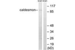 Western blot analysis of extracts from mouse brain cells, using Caldesmon (Ab-759) Antibody.